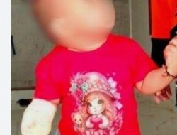 Kepala PKM Bolo Bilang Sudah Sesuai Prosedur: Lalu Dimana Prosedur yang Menyelamatkan Tangan Arumi?