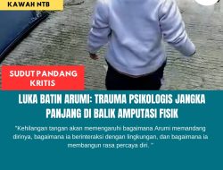 Luka Batin Arumi: Trauma Psikologis Jangka Panjang Di Balik Amputasi Fisik